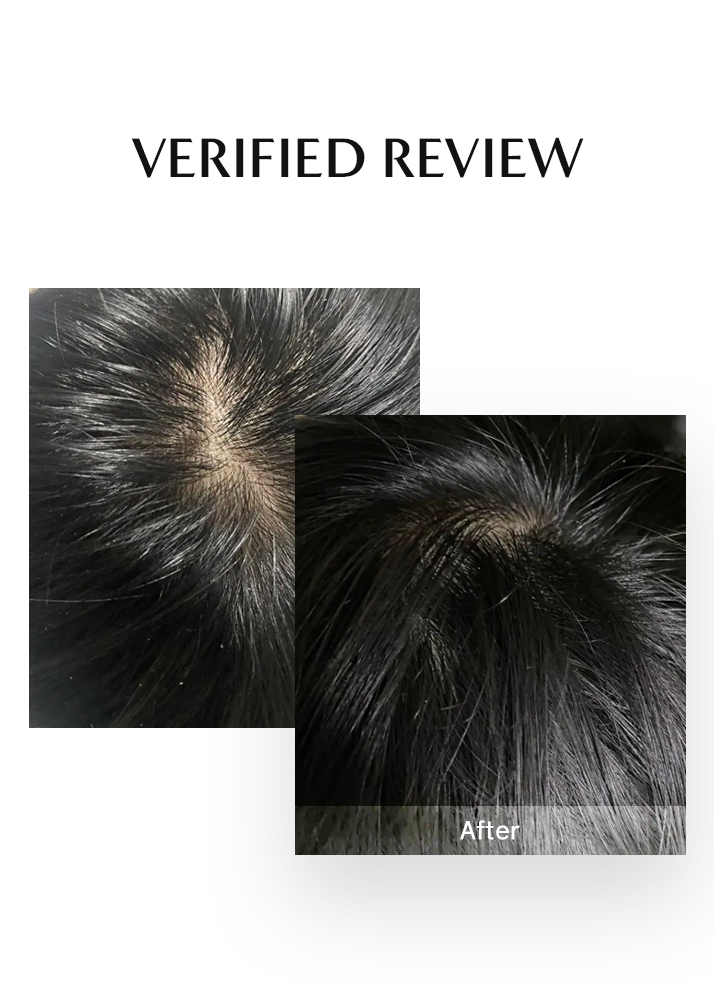 Before and after comparison of hair growth treatment on a white background