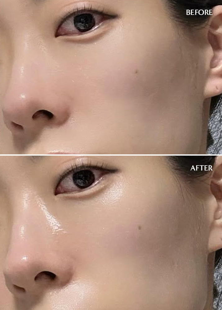 Before and after comparison of a person's eye area with visible skin texture differences.
