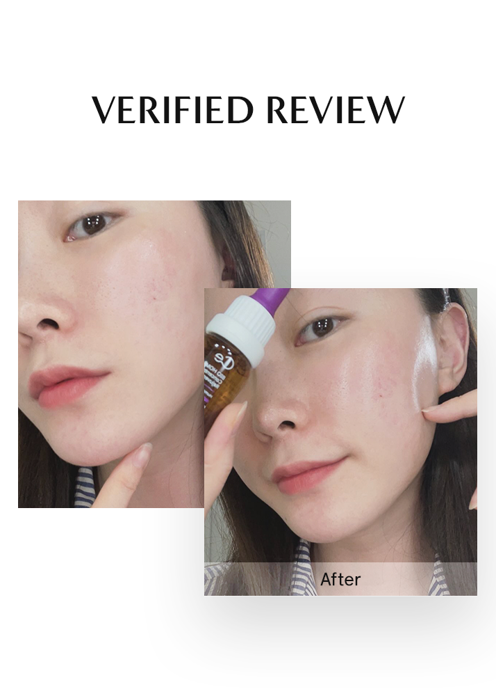 Before and after comparison of a person's face with a skincare product, labeled 'Verified Review'.