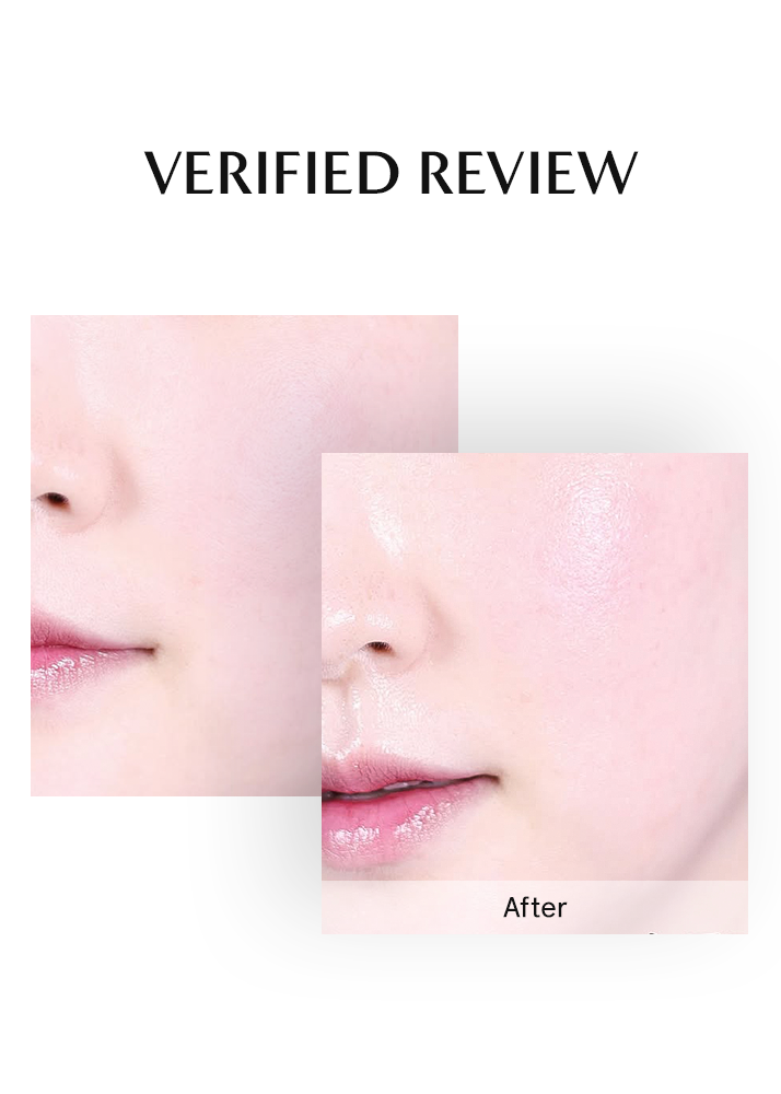 Before and after comparison of a person's lips with 'After' labeled on a white background.