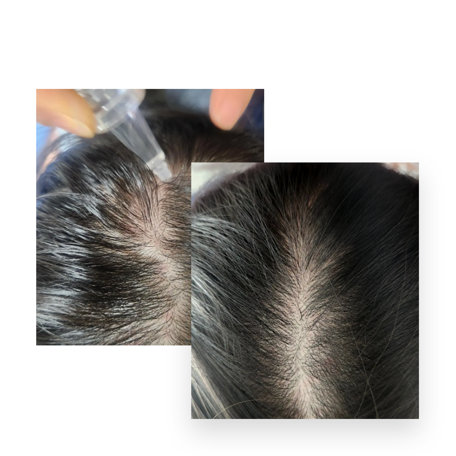 Before and after image showing visible improvement in hair parting and density