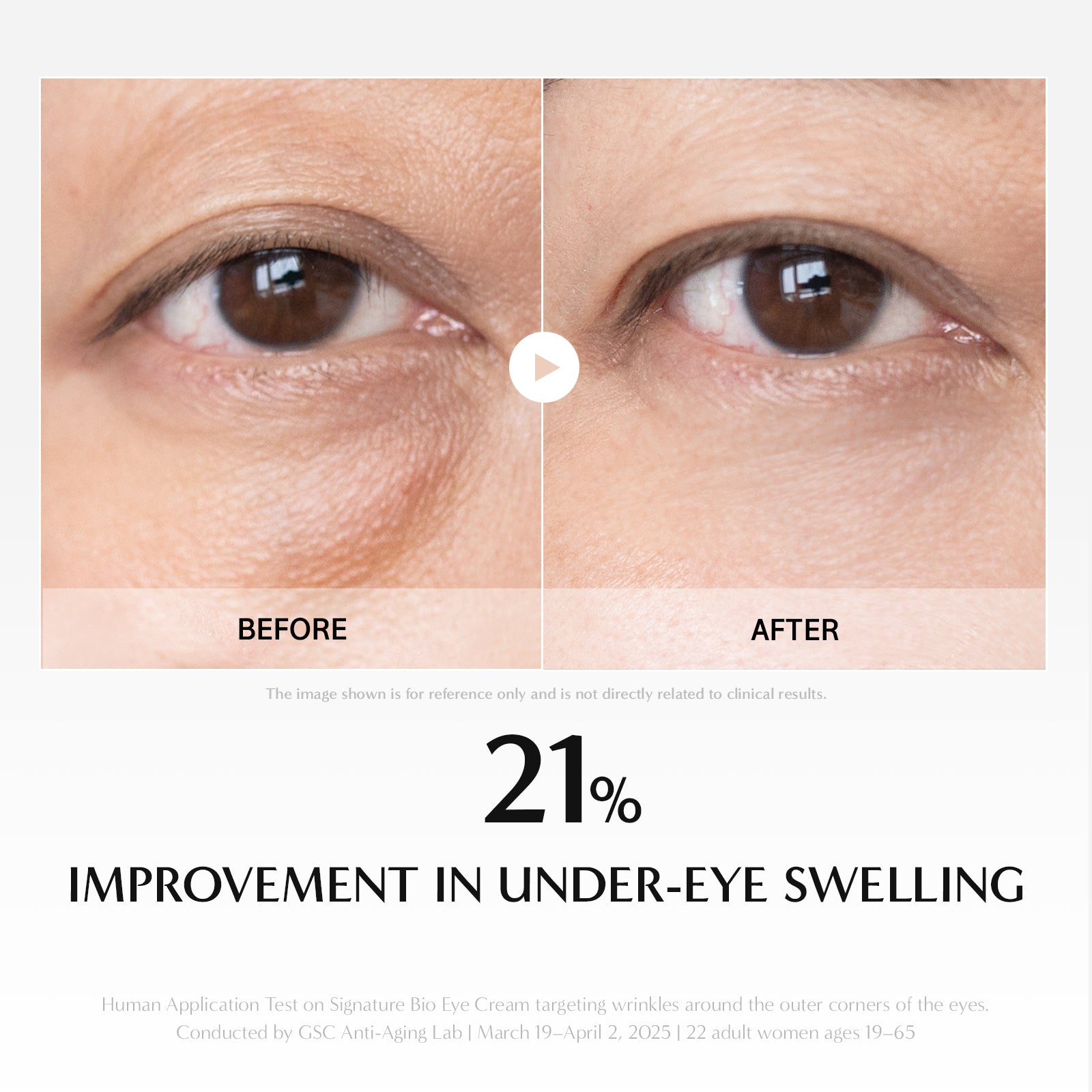 Before and after comparison of under-eye swelling with a 21% improvement shown.