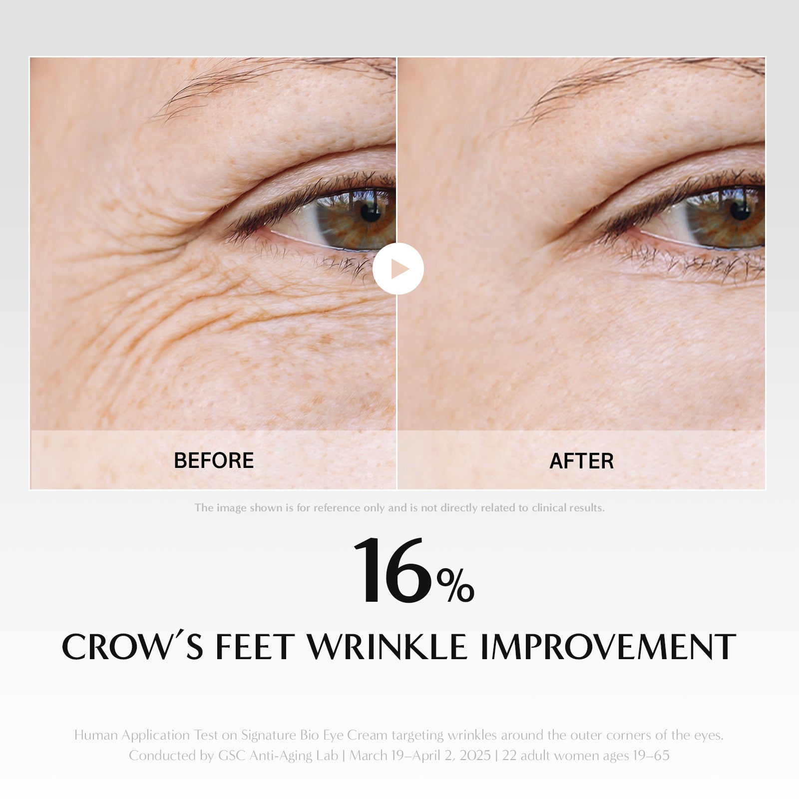 Before and after comparison of crow's feet wrinkles with a 16% improvement shown.